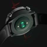 Xiaomi Mibro Watch A1 Tarnish